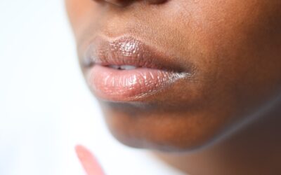 Comment soigner les lèvres gercées ?